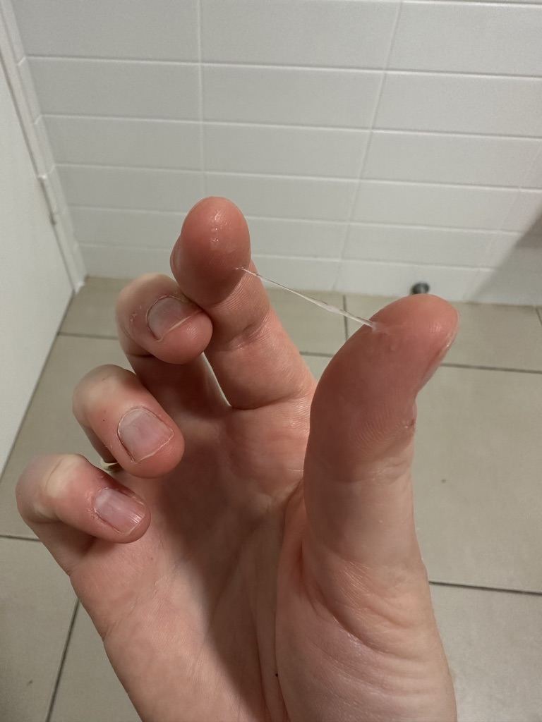 Stretchy, clear, lubricative cervical mucus