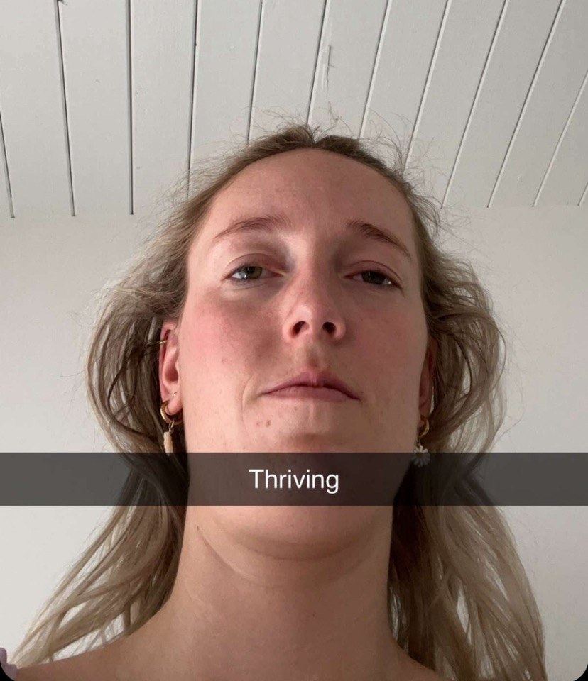 Selfie of Hales looking exhausted, captioned Thriving